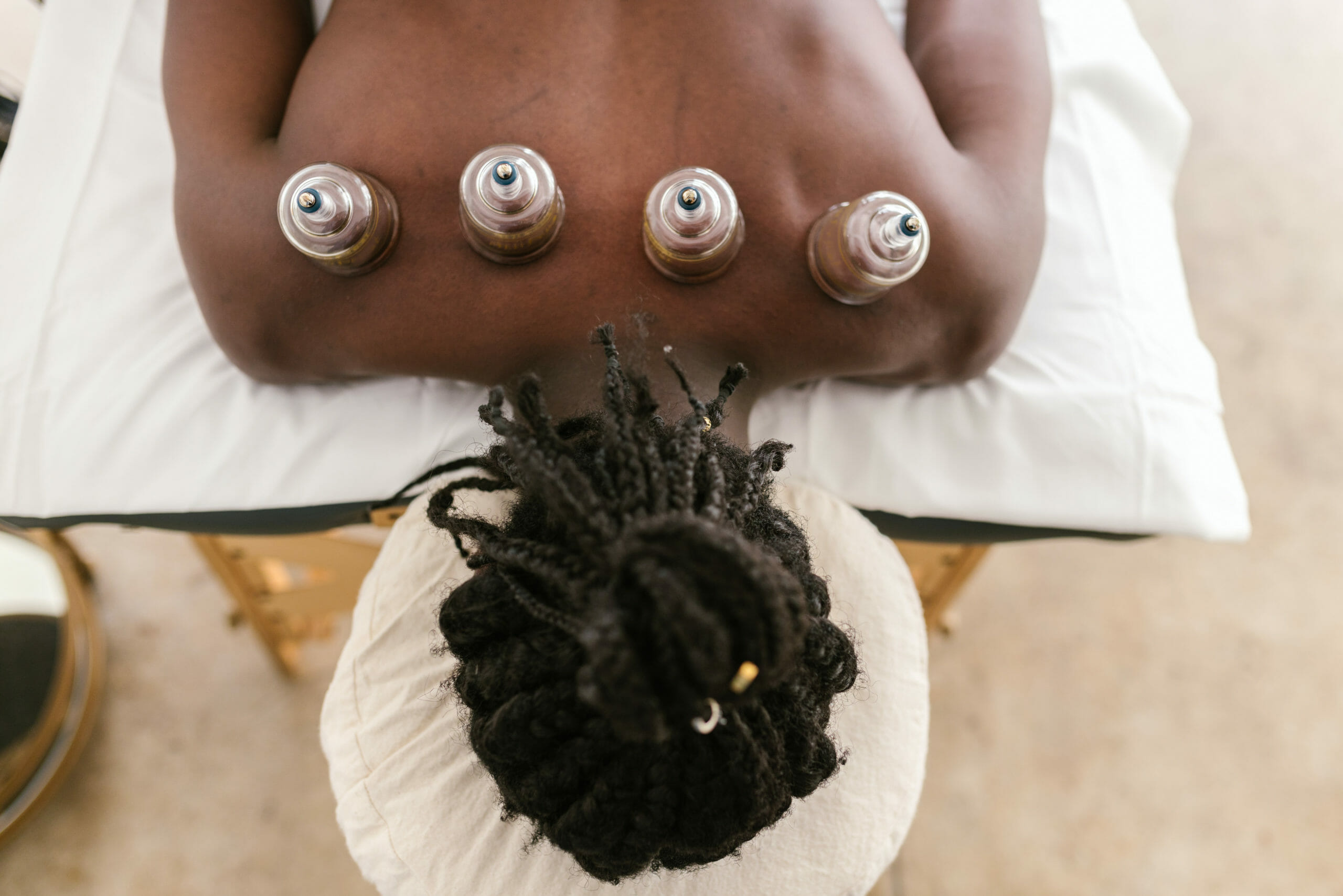 Curious about Cupping? - Spinal Care Clinics